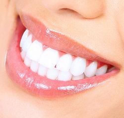 Teeth whitening is a simple way to enhance your smile and self-confidence