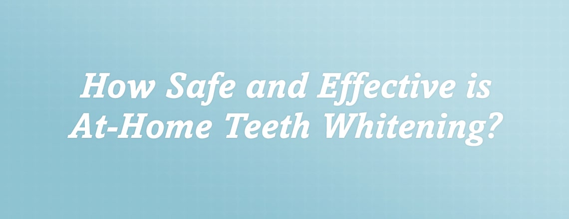 at-home-teeth-whitening.jpg