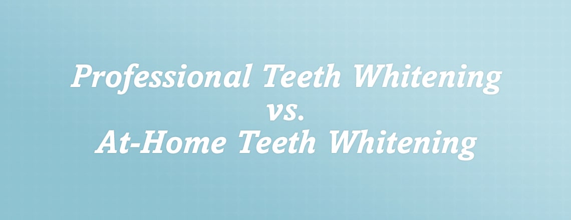 professional-teeth-whitening-vs-at-home.jpg