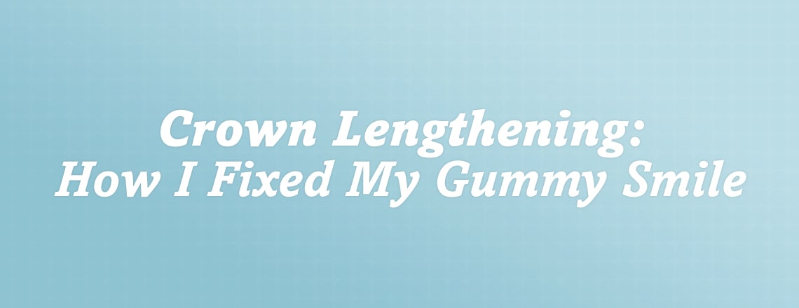 crown-lengthening-how-i-fixed-my-gummy-smile-with-simple-procedure.jpg