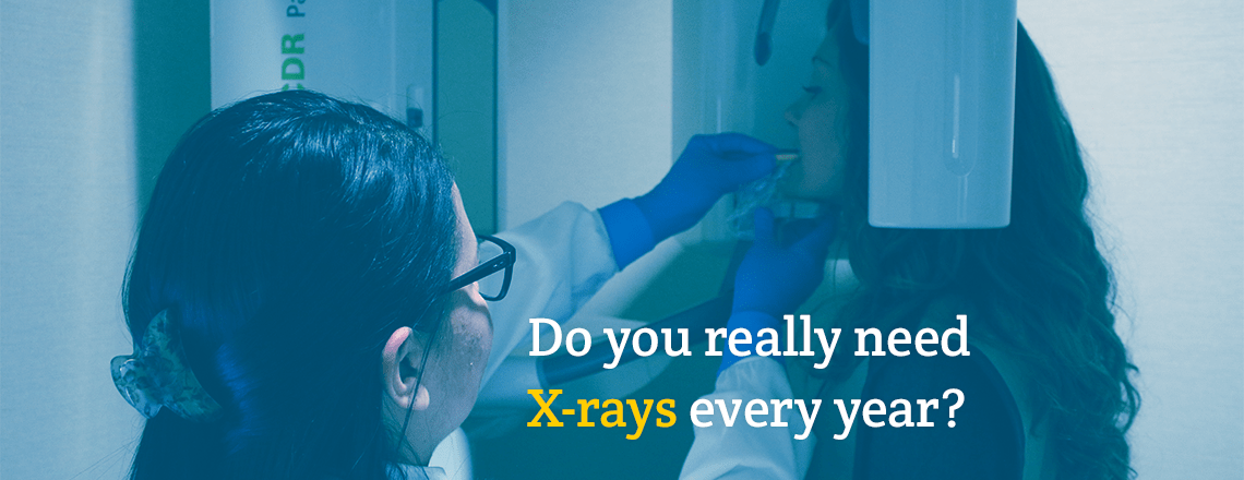 Do I Really Need An X-Ray Every Year?