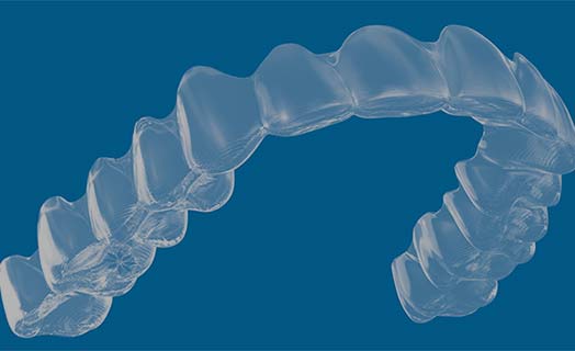 Learn about Invisalign clear aligners.