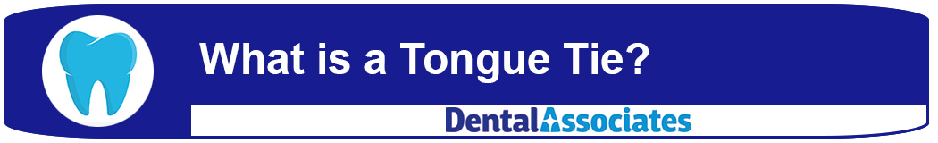 What is a Tongue Tie?
