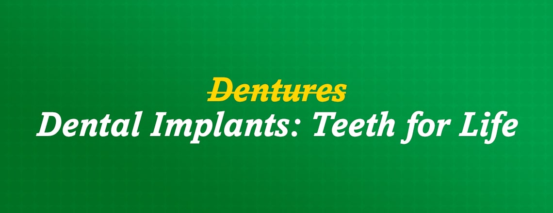 The benefits of dental implants over dentures