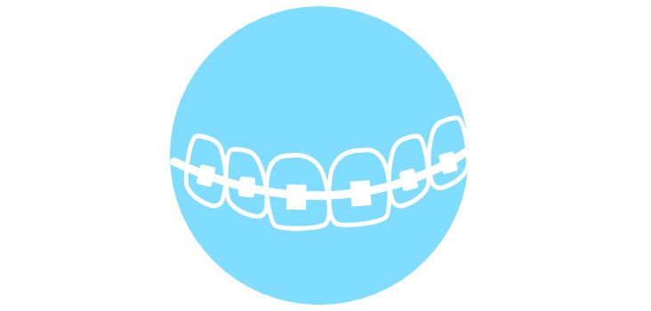 Traditional Braces