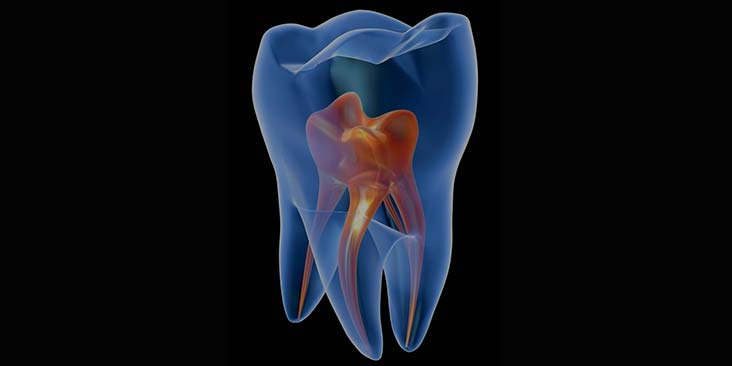 Learn more about root canal therapy.