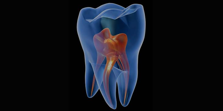 Learn more about root canal therapy.