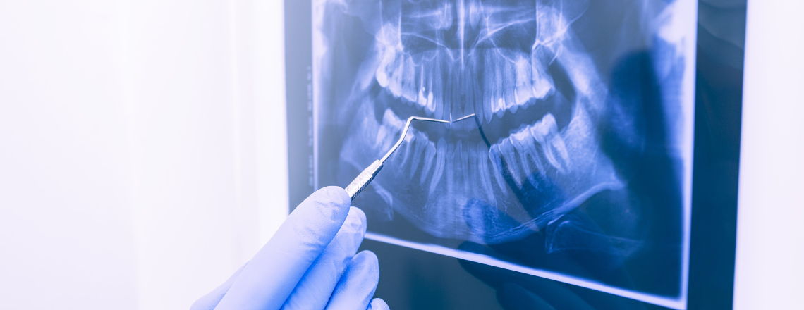 Are X-rays harmful?