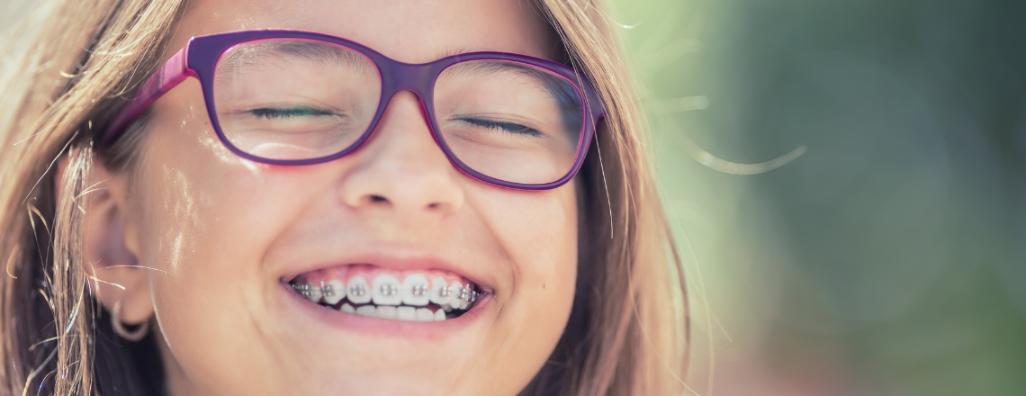 What braces cost and how to pay for them