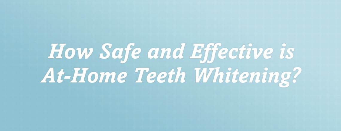 at-home-teeth-whitening.jpg