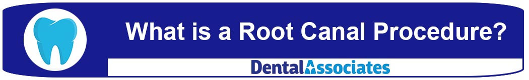 Root Canal