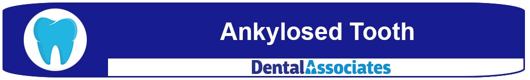 Ankylosed Tooth