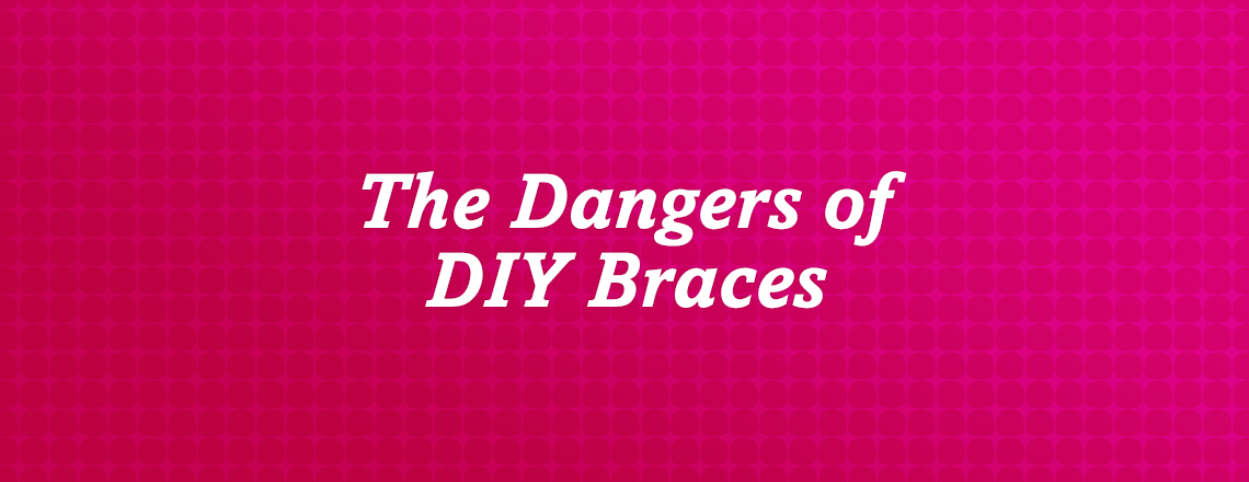 Learn the dangers of DIY braces