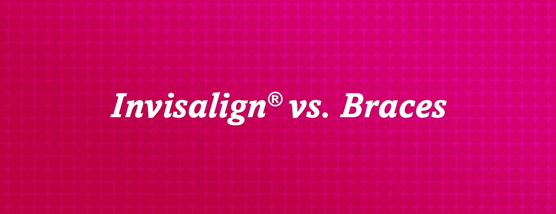 Learn about the benefits of Invisalign vs. braces