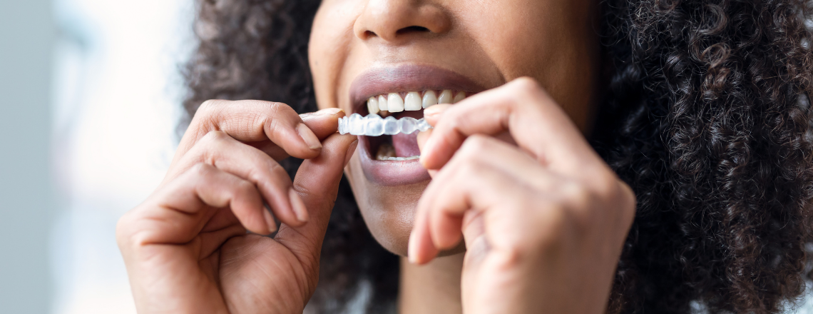Are Direct-to-Consumer Aligners Effective?