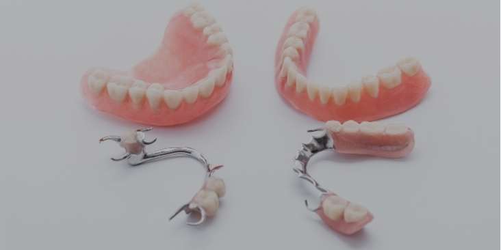 Replacing your dentures with dental implants.