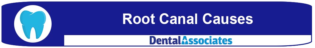 Root Canal Causes