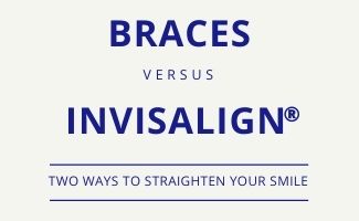 Our comparison of features between Invisalign clear aligners and traditional braces.