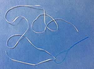 Floss threader for braces