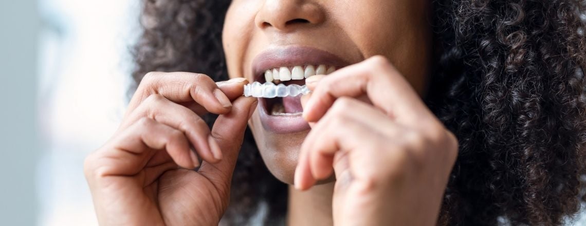 young woman holding her clear aligner tray and putting them in her mouth
