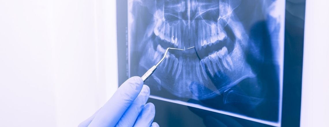 x-ray image 