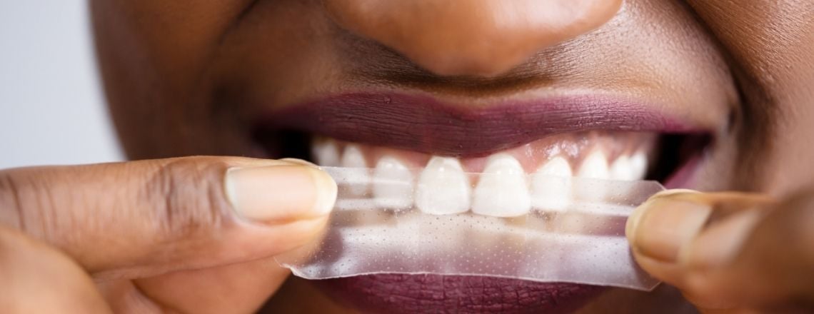 young woman holding at-home teeth whitening strips to her teeth