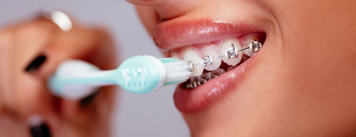 woman with braces brushing her teeth