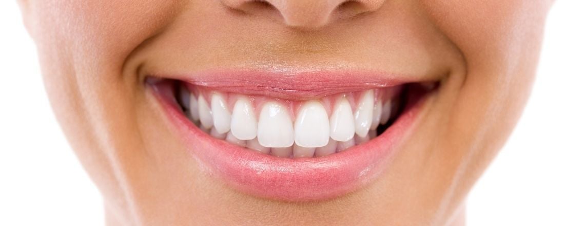 A close-up shot of a perfect white smile showing clean teeth and healthy gums.