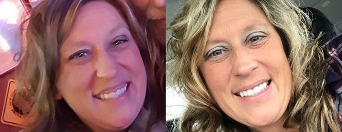 Side-by-side before and after photos of a smiling woman's transformation.