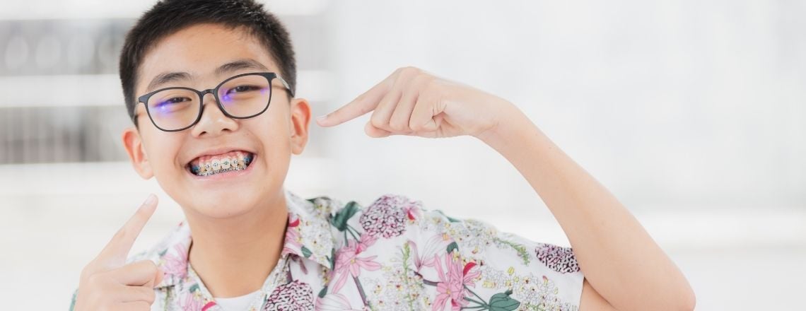 young man smiling and pointing to his braces