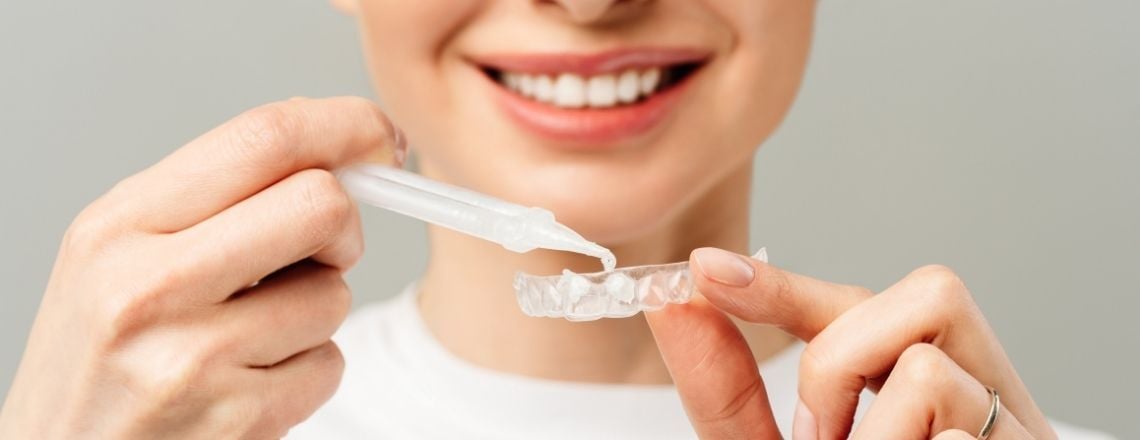 woman squeezing teeth whitening gel into teeth whitening trays