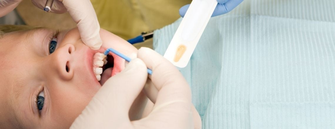 young child receiving fluoride treatment