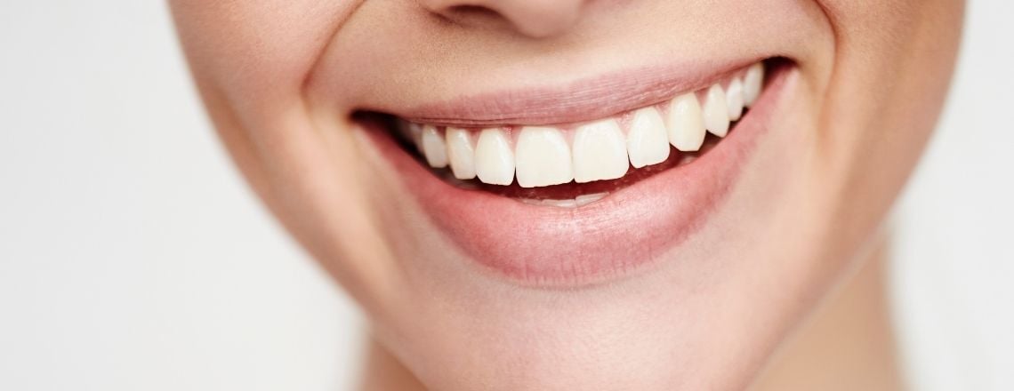 Close-up of a person smiling with perfectly straight, bright white teeth.
