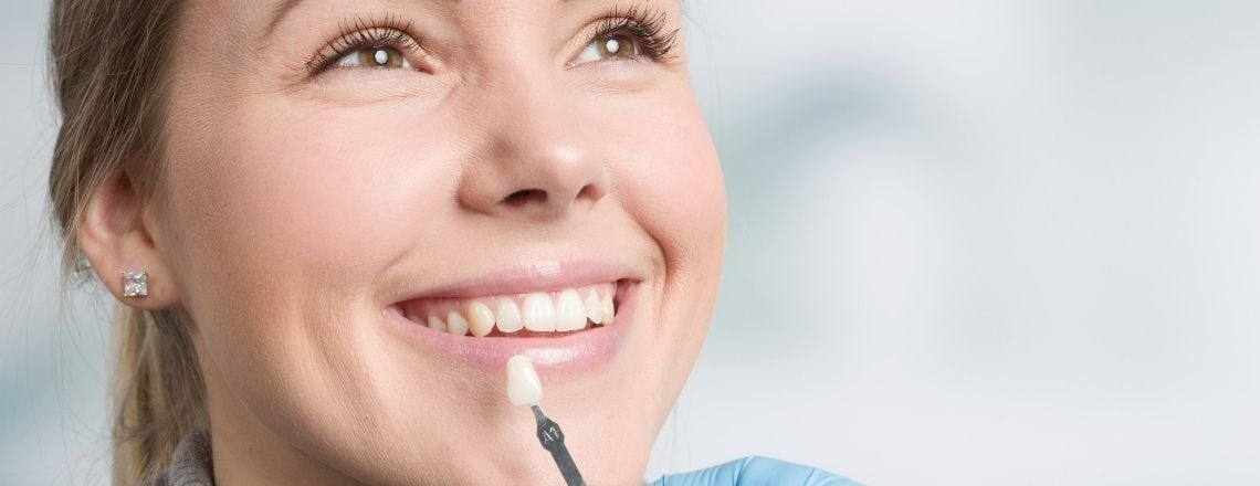 A dentist matches a woman's tooth shade using a dental color guide for a whitening or cosmetic procedure.