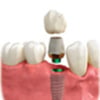 all-treatment-options-1