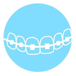 An illustration of traditional braces on a blue background