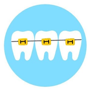 colored-bands-1