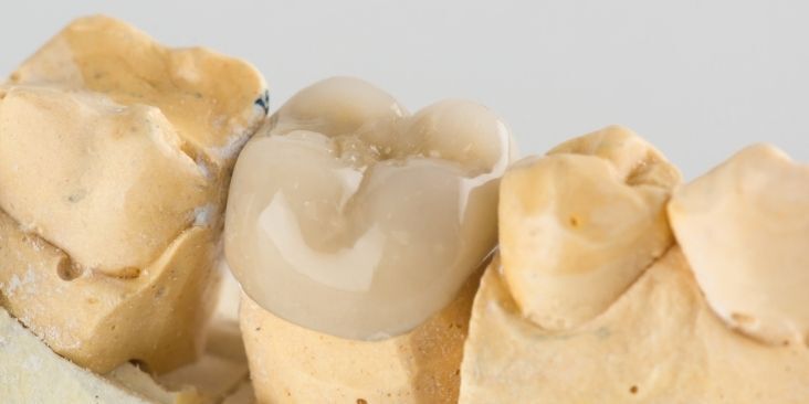 dental-crown