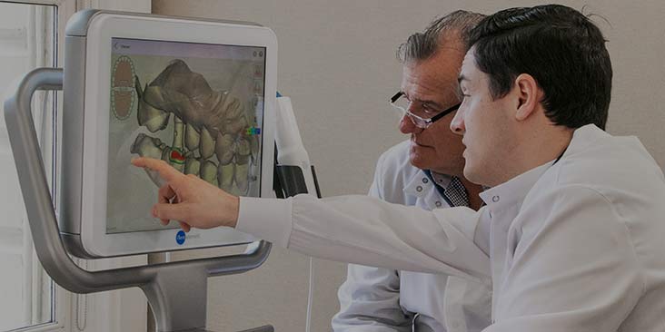 dental-veneers-implants
