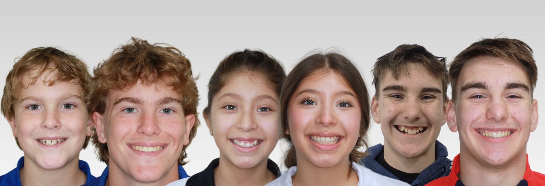 Orthodontics before and after at Dental Associates