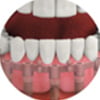 replacing-all-your-teeth